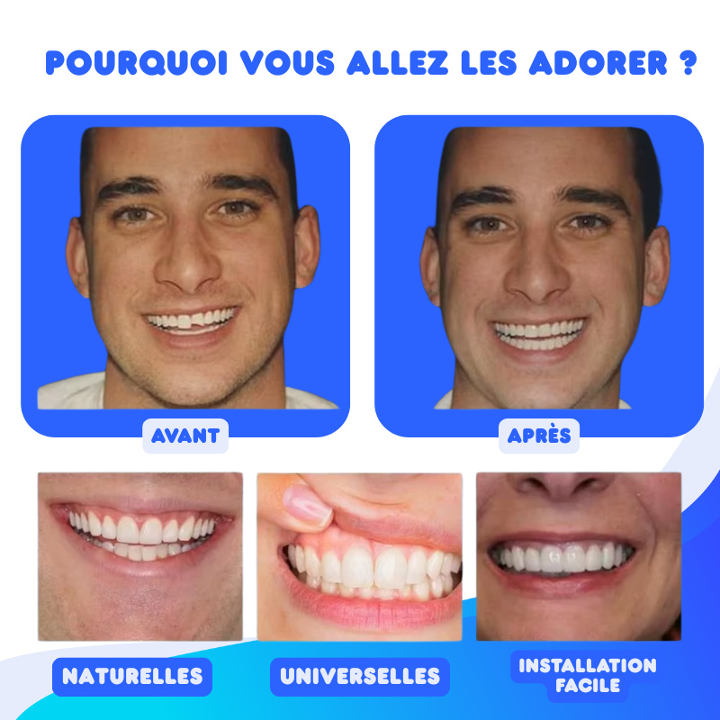 Kit de Prothèse Dentaire - Correction Instantanée du Sourire
