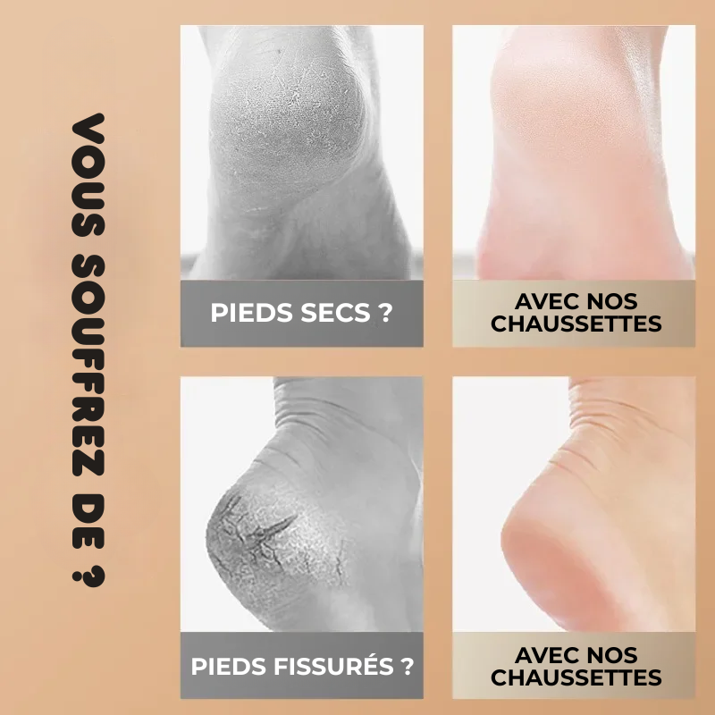 Chaussettes de Protection SmartGel pour Talon - 1 PAIRE ACHETÉE = 1 OFFERTE