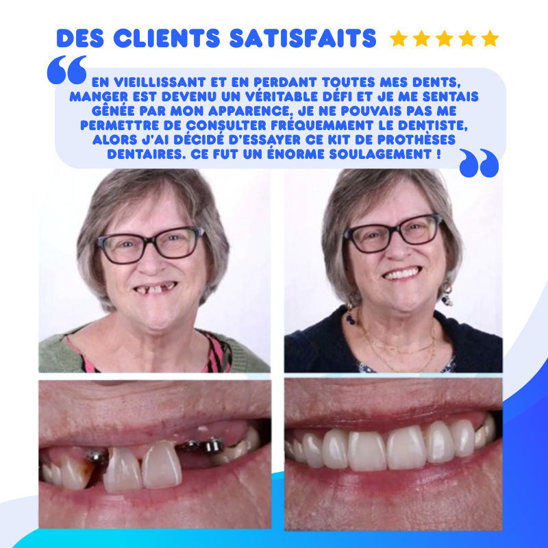 Kit de Prothèse Dentaire - Correction Instantanée du Sourire